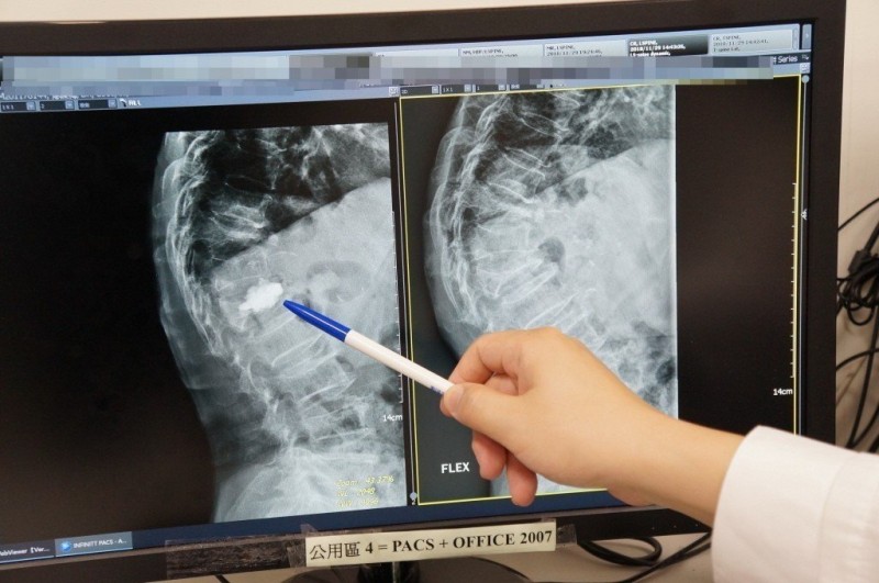 健檢照X光會得甲狀腺癌！艾美獎博士說的能信嗎？