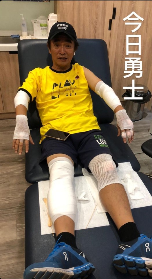 吳宗憲錄《玩很大》摔車「四肢全受傷」！　緊急中斷錄影送回台北